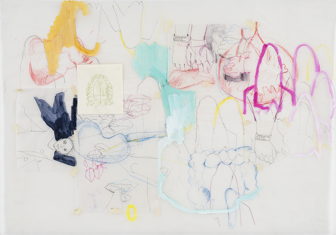 Apendicitis, casi peritonitis